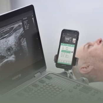 Ultrasonido Medico